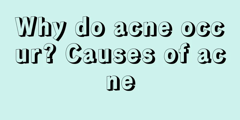 Why do acne occur? Causes of acne