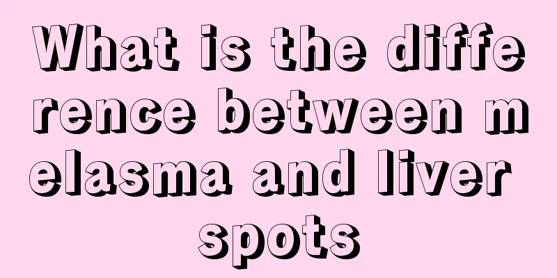 What is the difference between melasma and liver spots
