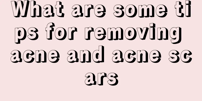 What are some tips for removing acne and acne scars