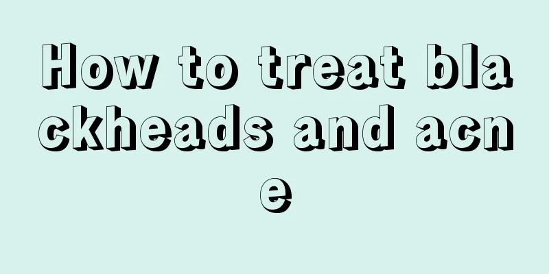 How to treat blackheads and acne