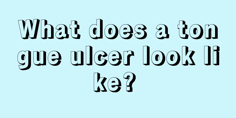 What does a tongue ulcer look like? 