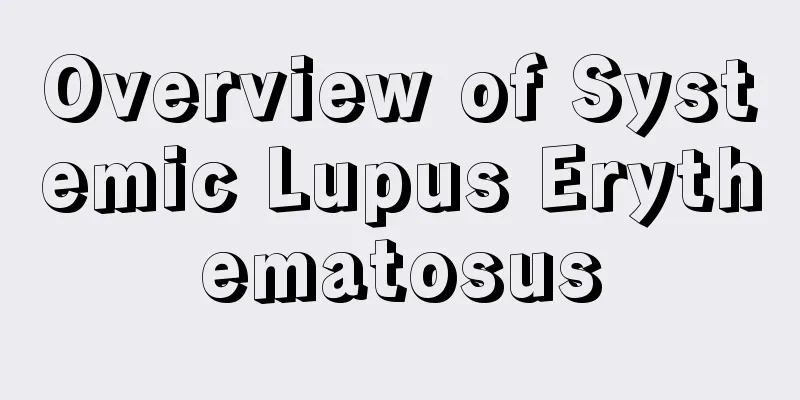 Overview of Systemic Lupus Erythematosus