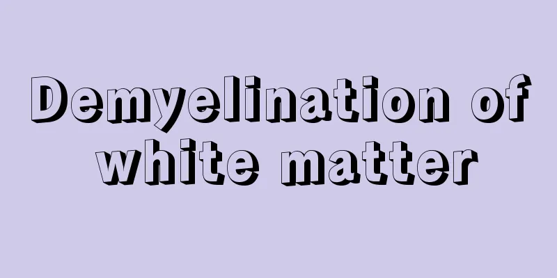 Demyelination of white matter