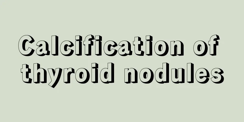 Calcification of thyroid nodules