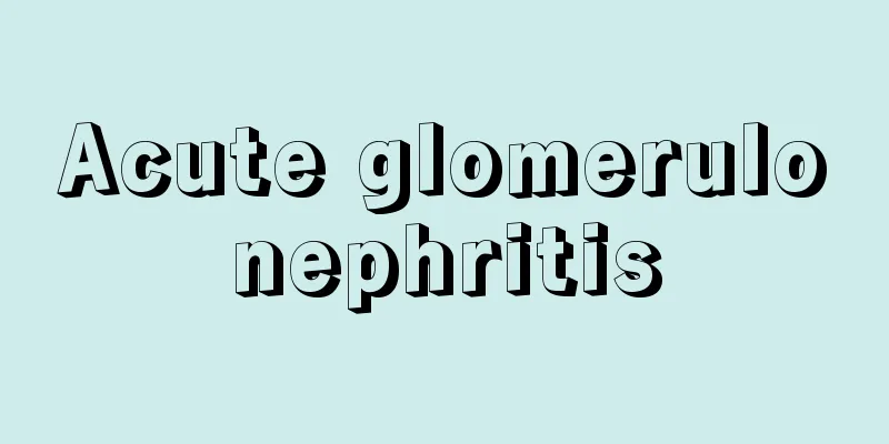 Acute glomerulonephritis