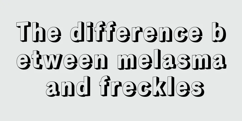 The difference between melasma and freckles