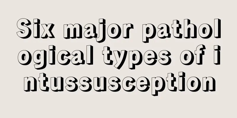 Six major pathological types of intussusception