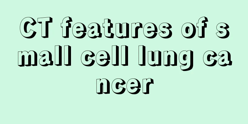 CT features of small cell lung cancer
