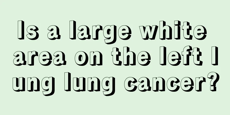 Is a large white area on the left lung lung cancer?