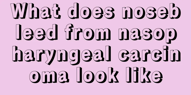 What does nosebleed from nasopharyngeal carcinoma look like