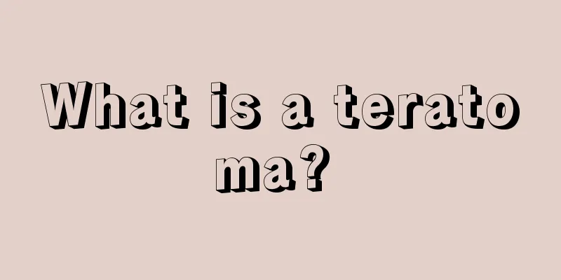 What is a teratoma? 