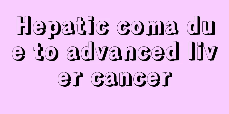 Hepatic coma due to advanced liver cancer