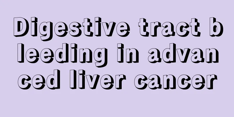 Digestive tract bleeding in advanced liver cancer