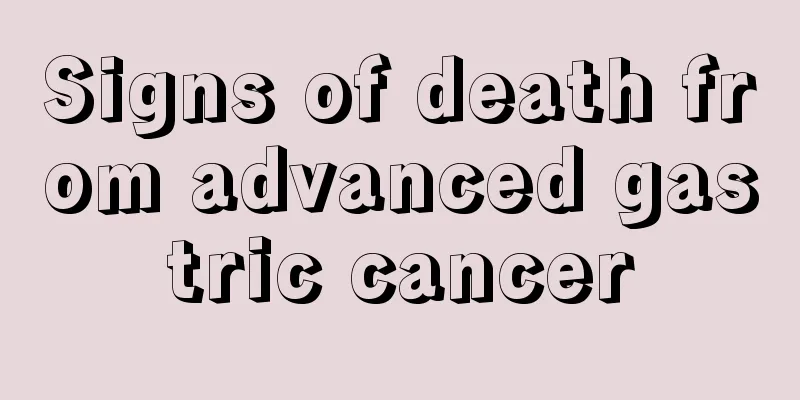 Signs of death from advanced gastric cancer
