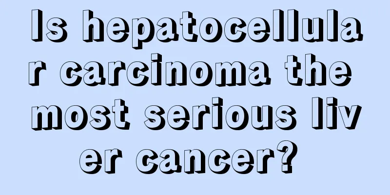 Is hepatocellular carcinoma the most serious liver cancer? 