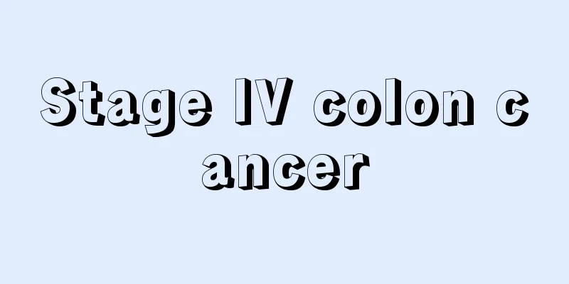 Stage IV colon cancer
