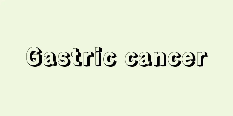 Gastric cancer