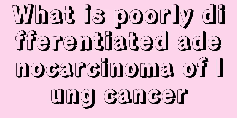 What is poorly differentiated adenocarcinoma of lung cancer