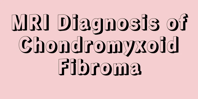 MRI Diagnosis of Chondromyxoid Fibroma