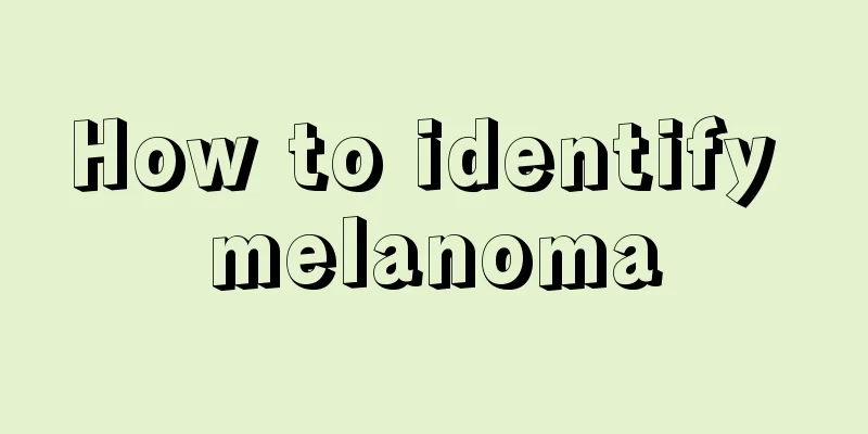 How to identify melanoma