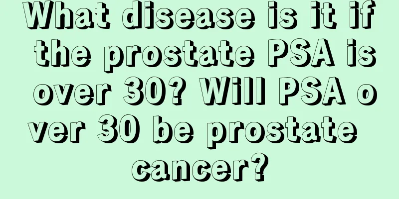 What disease is it if the prostate PSA is over 30? Will PSA over 30 be prostate cancer?