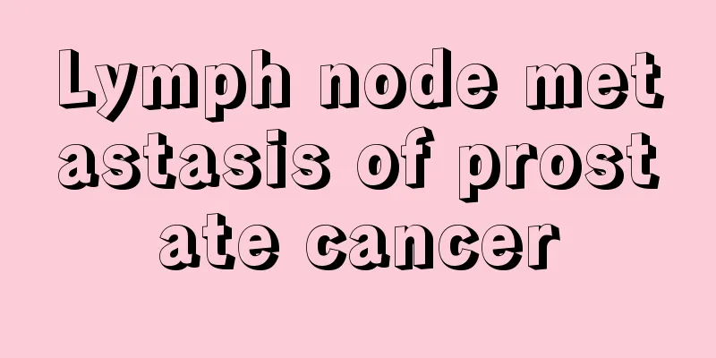Lymph node metastasis of prostate cancer
