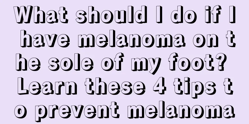 What should I do if I have melanoma on the sole of my foot? Learn these 4 tips to prevent melanoma