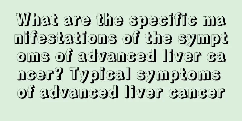What are the specific manifestations of the symptoms of advanced liver cancer? Typical symptoms of advanced liver cancer
