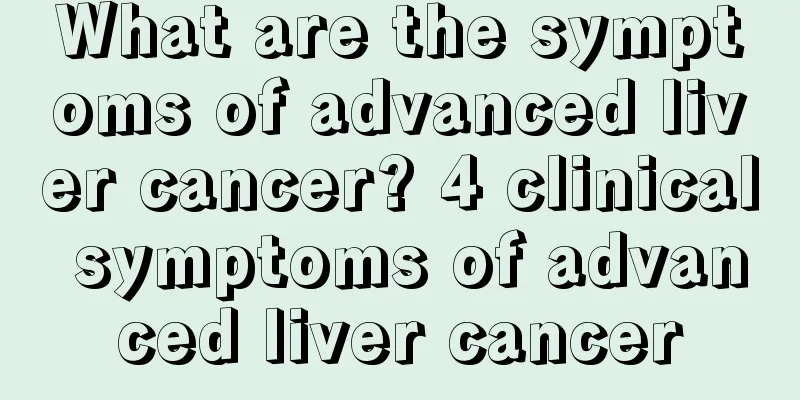 What are the symptoms of advanced liver cancer? 4 clinical symptoms of advanced liver cancer