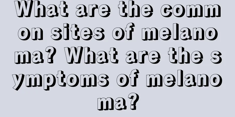 What are the common sites of melanoma? What are the symptoms of melanoma?