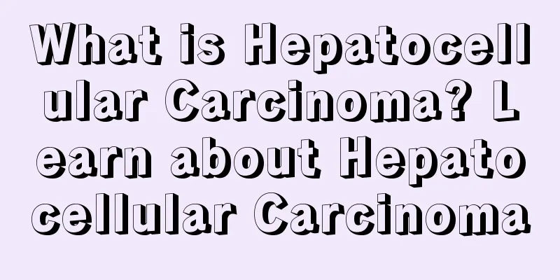 What is Hepatocellular Carcinoma? Learn about Hepatocellular Carcinoma