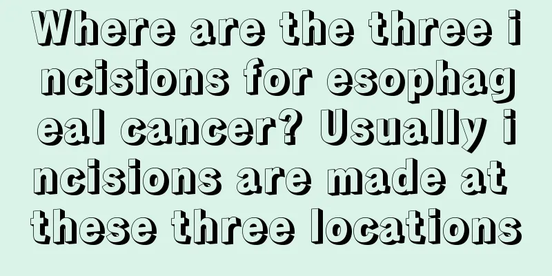 Where are the three incisions for esophageal cancer? Usually incisions are made at these three locations