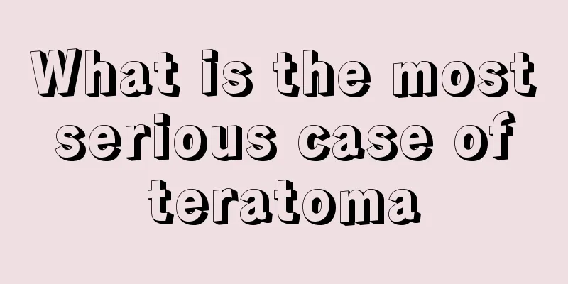 What is the most serious case of teratoma
