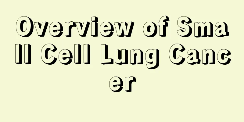 Overview of Small Cell Lung Cancer