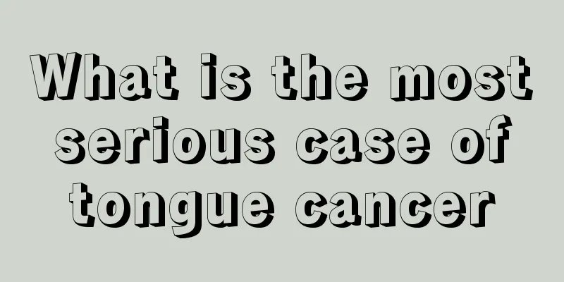 What is the most serious case of tongue cancer