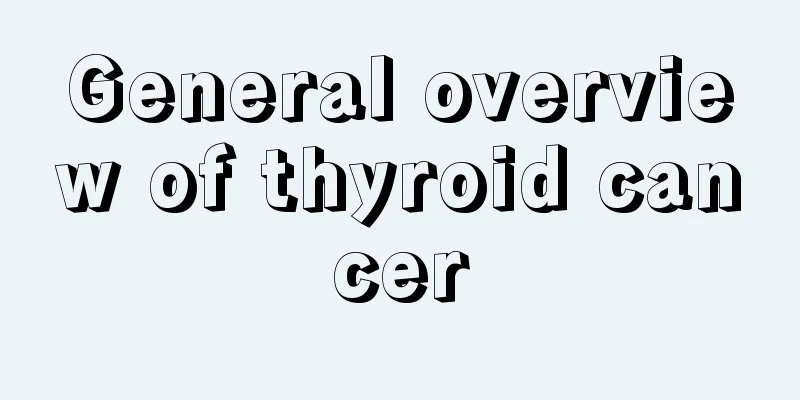 General overview of thyroid cancer