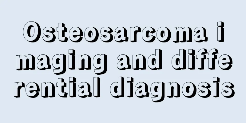 Osteosarcoma imaging and differential diagnosis