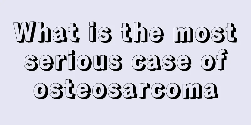 What is the most serious case of osteosarcoma