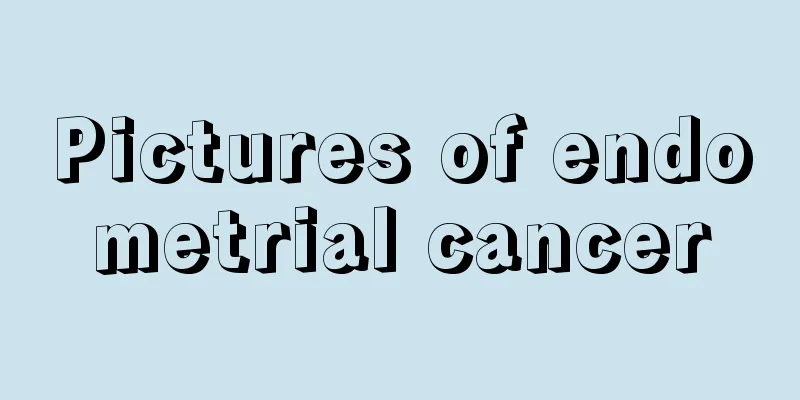 Pictures of endometrial cancer