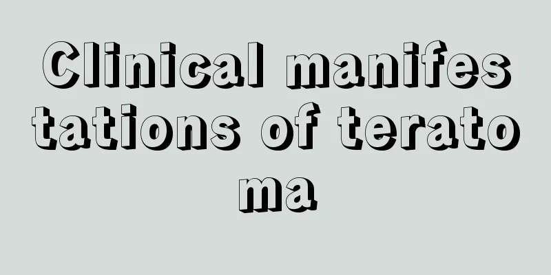 Clinical manifestations of teratoma