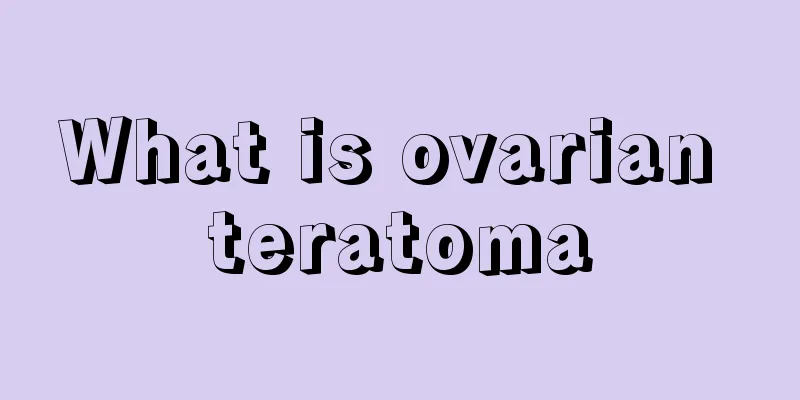 What is ovarian teratoma