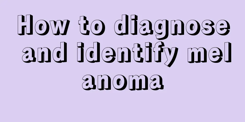 How to diagnose and identify melanoma