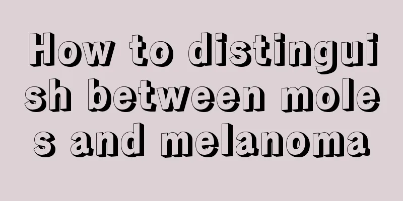 How to distinguish between moles and melanoma