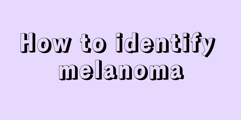How to identify melanoma