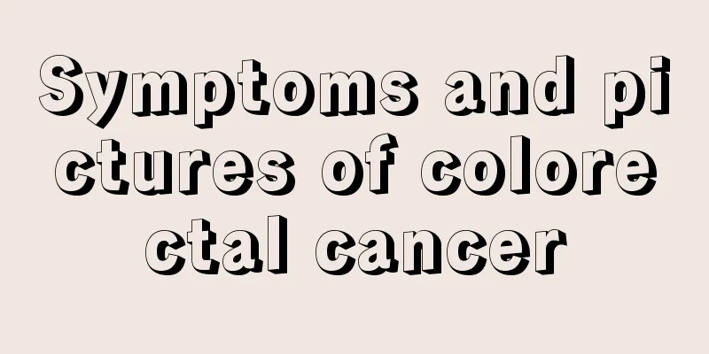Symptoms and pictures of colorectal cancer