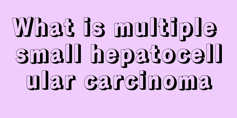 What is multiple small hepatocellular carcinoma