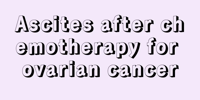 Ascites after chemotherapy for ovarian cancer