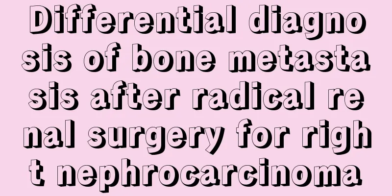 Differential diagnosis of bone metastasis after radical renal surgery for right nephrocarcinoma
