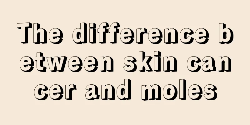 The difference between skin cancer and moles