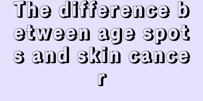 The difference between age spots and skin cancer
